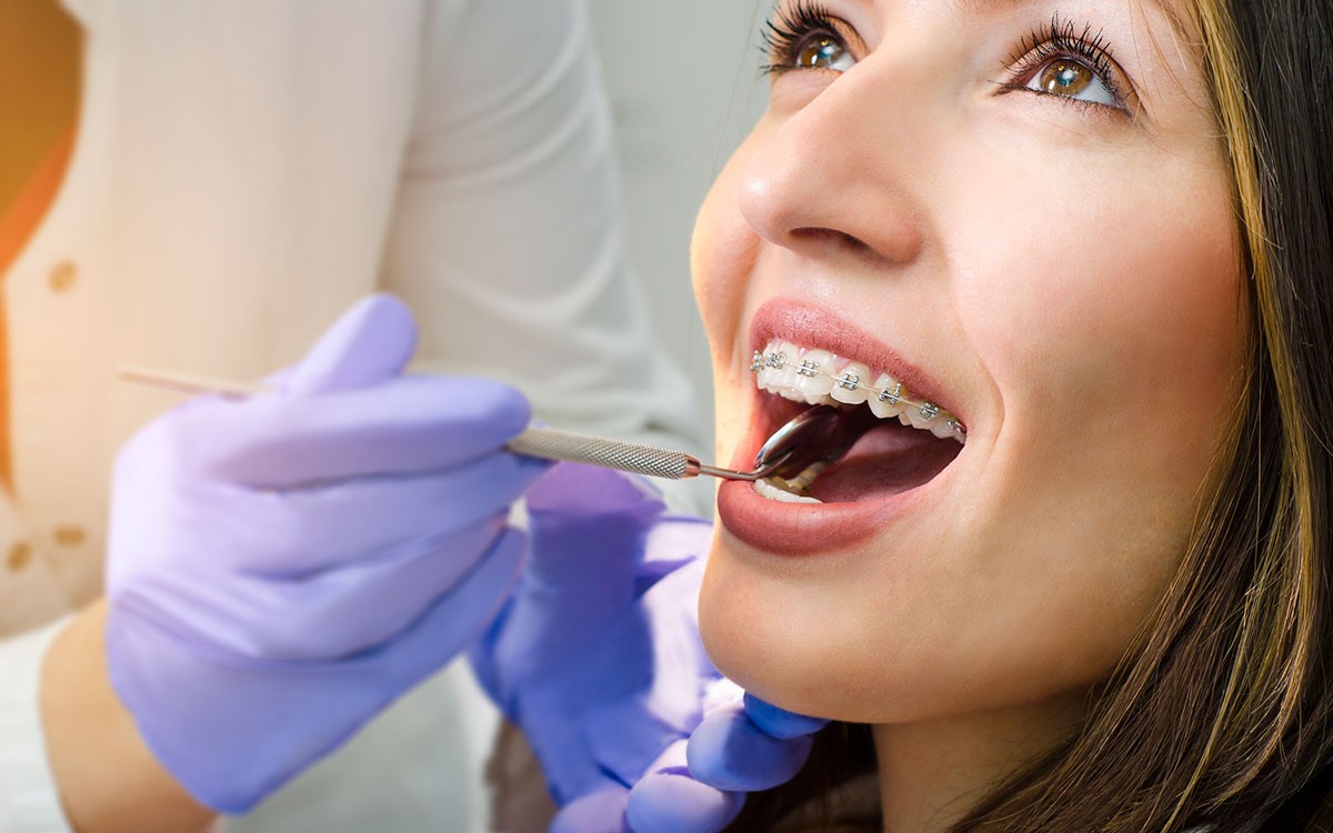 تفاوت دندانپزشک و ارتودنتیست