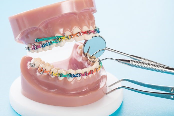 سوابق ارتودنسی دندان