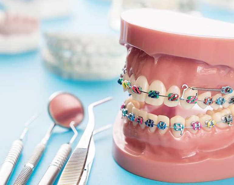 سوابق ارتودنسی دندان