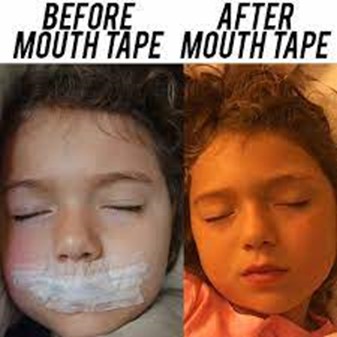 نوار چسب زدن به دهان راهکار درمان خروپف