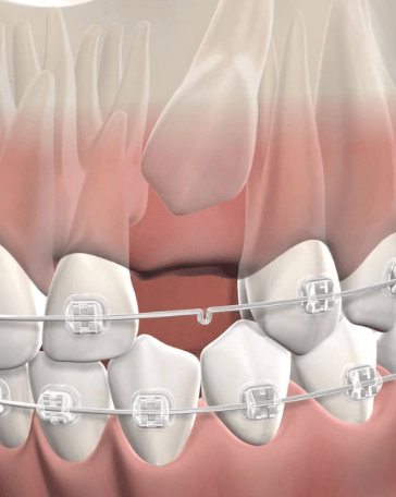 شکستن افسانه دندان شیری