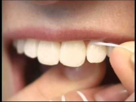 آناتومی دندان و اهمیت نخ دندان