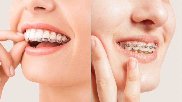 الاینرهای شفاف چیست؟