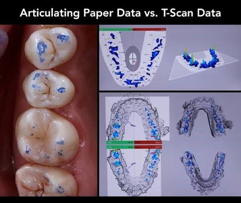 مکانیسم کار T-Scan